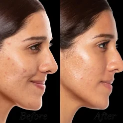 Sunday Riley A+ High-Dose Retinoid Serum 30ml Hot