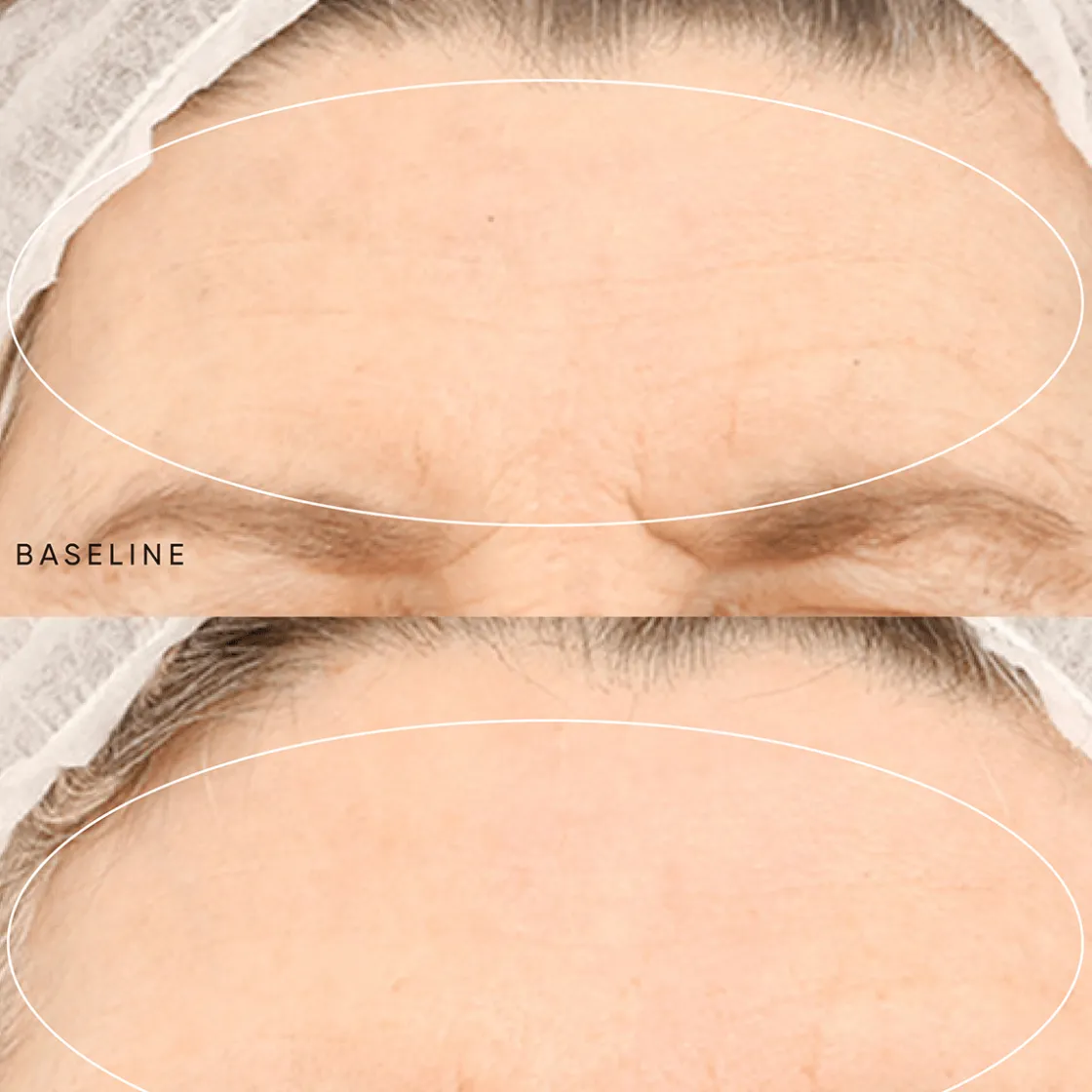 Irene Forte Night Renewal Travel Kit Hot