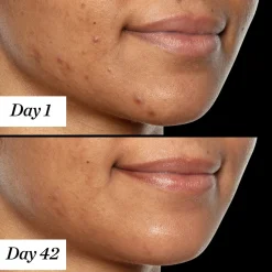 Sunday Riley U.F.O. Ultra Clarifying Treatment Face Oil 35ml Online